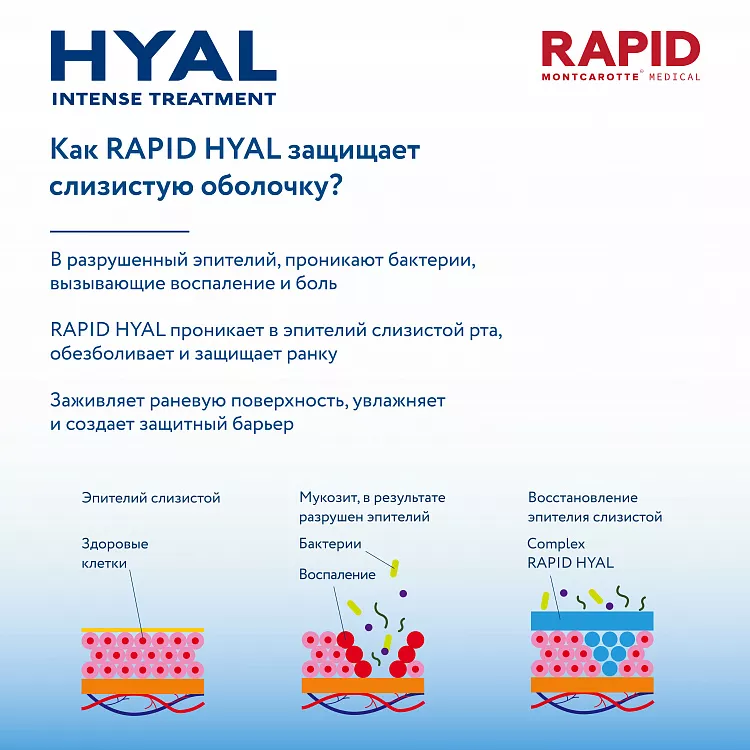 Toothpaste HYAL Intense Treatment 30 ml